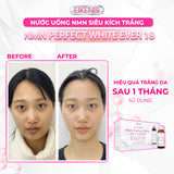 Nước uống kích trắng NMN Perfect White Ever 18 Eikenbi (10 lọ).