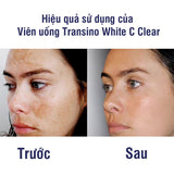 Viên uống trắng da mờ nám Transino WhiteC clear Nhật Bản