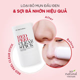 Thanh Lăn Hỗ Trợ Giảm Mụn Đầu Đen So'Natural Red Peel Clear Stick Blackhead & Face Clear Pore Stick