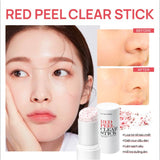 Thanh Lăn Hỗ Trợ Giảm Mụn Đầu Đen So'Natural Red Peel Clear Stick Blackhead & Face Clear Pore Stick