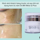 Kem Trị Nám Trắng Da Dr.MH Mela Q Plus