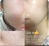 Serum nhân sâm vàng chống lão hoá, xoá mờ nếp nhăn Frigga Hàn Quốc