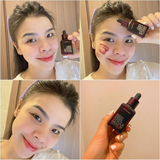 Serum  Peel Da Sinh Học Red Peel Tingle Serum Premium Texture So Natural