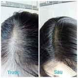 Tinh dầu kích mọc tóc và giãm rụng tóc  Hair Tonic Nhật Bản - Hương bưởi cam quýt