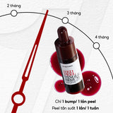 Tinh Chất Tái Tạo, Thay Da Sinh Học So Natural Red Peel Tingle Serum