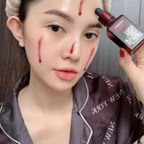 Serum  Peel Da Sinh Học Red Peel Tingle Serum Premium Texture So Natural