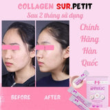 Bột Collagen thượng hạng trẻ hoá, trắng da Sur.Petit Hàn Quốc