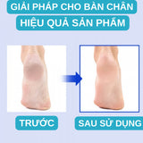 Kem Dưỡng Da Chân Và Giảm Thô Ráp Gót Chân TO-PLAN