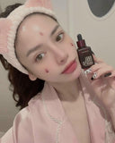 Serum  Peel Da Sinh Học Red Peel Tingle Serum Premium Texture So Natural