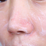 Thanh Lăn Hỗ Trợ Giảm Mụn Đầu Đen So'Natural Red Peel Clear Stick Blackhead & Face Clear Pore Stick