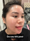 Peel Da Collagen Nano Căng Bóng Real Collagen Fit