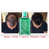 Tinh Dầu Mọc Tóc Yanagiya Hair Tonic Nhật Bản - Hương bạc hà