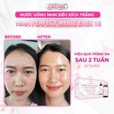 Nước uống kích trắng NMN Perfect White Ever 18 Eikenbi (10 lọ).