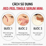 Tinh Chất Tái Tạo, Thay Da Sinh Học So Natural Red Peel Tingle Serum